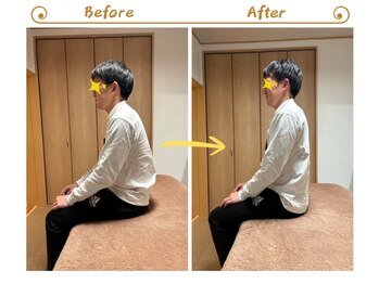 アイノテ メディカルボディケア(Ainote medical body care)/［首・肩こりの施術例紹介］