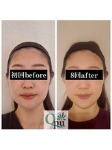 キュープ 静岡店(Qpu)/続けた結果がこちら！