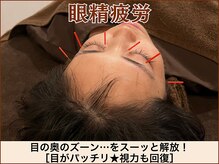 A1スポーツマッサージ治療院/【眼精疲労】肩こり・スマホ首