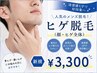 【新規】メンズ顔脱毛¥3,300