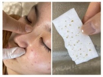 ジューンブライド(June Bride 61)/毛穴ケア