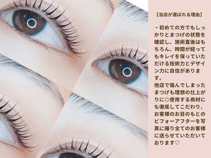 ナナゴー(75)の写真