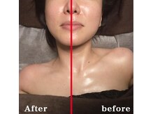 ノットノット 自由が丘(Not Knot)/オプション：首肩デコルテリンパ