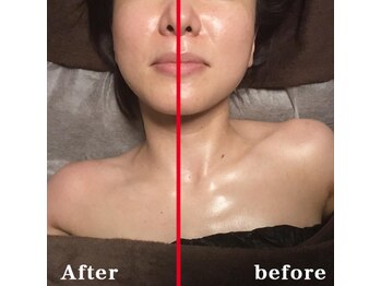 ノットノット 自由が丘(Not Knot)/オプション：首肩デコルテリンパ