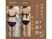 ヨサパーク リアン(YOSA PARK Lien)