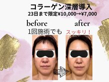 エステサロン プラスエー(+A)