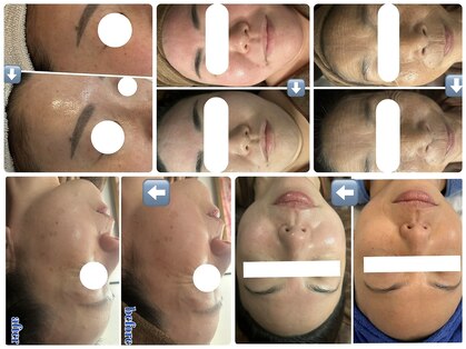 オーロラ(Aurora)の写真