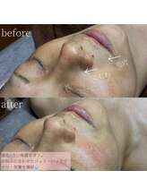 コモレビ(komorebi)/くすみ改善フェイスワックス♪