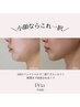 ＼小顔ならこれ一択／　お顔スッキリ【6/30まで★】モニター募集