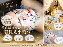 サプル(supple)
