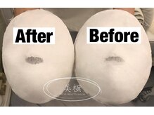 美極 トータルビューティー(美極 TOTAL BEAUTY)/恵比寿/小顔コルギ/エステ/