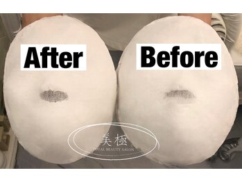 美極 トータルビューティー(美極 TOTAL BEAUTY)/恵比寿/小顔コルギ/エステ/