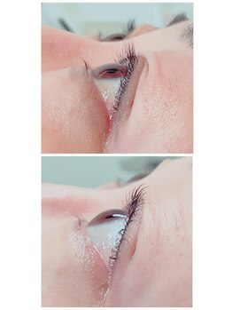 アデージョ(Adejio)/まつ毛パーマ