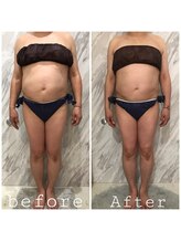 ラニ(LANI)/新型ハイパーナイフ6