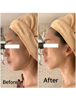 スペチアーレ 夙川/小顔ハイリフ×金糸×シャワー