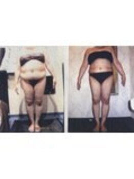 パーフェクトボディプレミアム 渋谷店(PERFECT BODY PREMIUM)/お客様 ビフォーアフター(3)