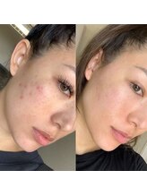 アイクイーン 亀戸(Eyequeen)/