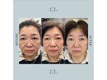 リチェルカ(ricerca)の雰囲気（ExoLift南大阪初導入店！エクソソームで根本改善  ExoLiftで検索）