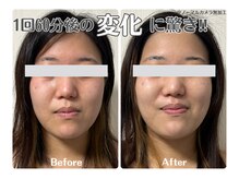 ルリアン(Lurian)/1回60分のBefore→After