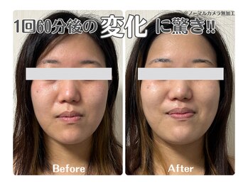 ルリアン(Lurian)/1回60分のBefore→After