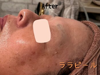 ダイヤモンド リーエンダ(Diamond leende)/ララピール