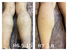 フィズ 五日市彩が丘店(FIS)/☆before/after☆都度払い