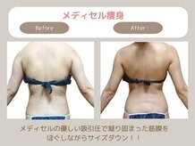 トレゾアスィス(Tresor sis)