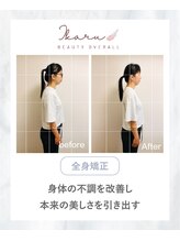 イカル 池袋(ikaru)/全身矯正 before after 04