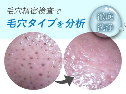 オーシャンブルー 福岡店(OCEAN BLUE フェイシャル&ボディ)の写真