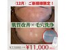 12月ご新規様限定！毛穴洗浄x肌質改善エステ¥22000→¥11000（特別価格）