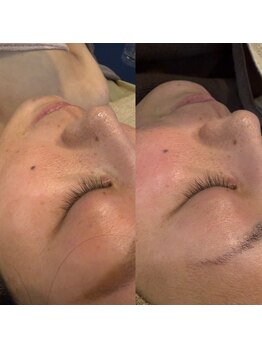 アジーク 町田店(AGEQUE)/速攻で毛穴レスな陶器肌