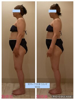 小顔コルギ専門店 フェルーシュ 成田駅前店(Feruche)/背中+下半身コルギ　1回目