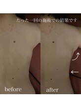 サロン ド ブリーズ(salon de breathe)/施術前後のお写真