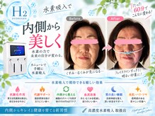 ヨサパーク ハーバルリーフ(YOSA PARK Herbal Leaf)