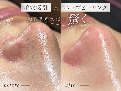 エステサロン ジョアアンジェ(joie ange)の写真