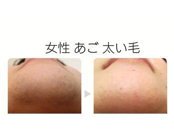 サロン ケー(salon K.)/出てくる悩みしっかりケアします