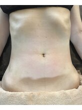 ビテ(Bite)/【くびれ腹】30代　会社員