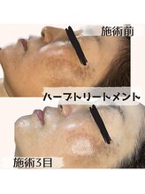 プレジー(prezzy)/くすみケア。美白に！