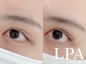 レピア 高槻店/韓国式LEPIA Before&After