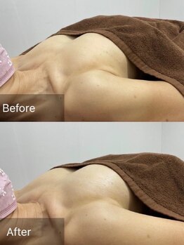 エーアイビューティー 柏店(Ai Beauty)/ 【バストアップ例】