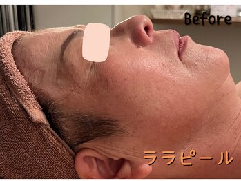 ダイヤモンド リーエンダ(Diamond leende)/ララピール