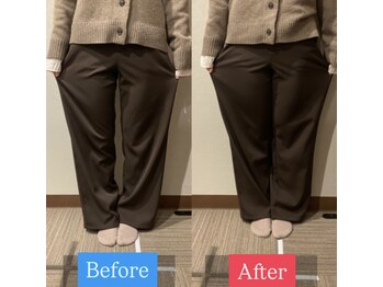 ナオル整体 宮崎院(NAORU整体)/20代女性施術事例【O脚改善】