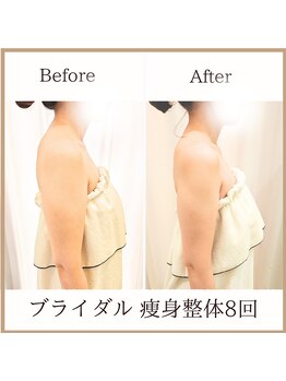 サロンルーチェ(Salon Luce)/ビフォーアフター/施術回数5回