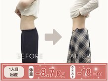 たどころ整骨院/産後骨盤矯正ダイエットの結果！