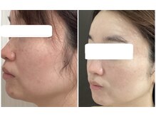 ロゼブランシュ(Rose Blanche)/