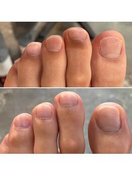 ニマ(nima)/足の爪も育爪中