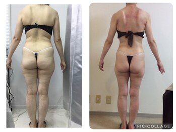 マッチ(much)/マシーンマッサージの組み合わせ