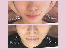 リフト 新宿西口(Lift)