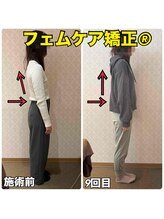 リズベット(LIZ BET)/フェムケア矯正でお股の緩み改善