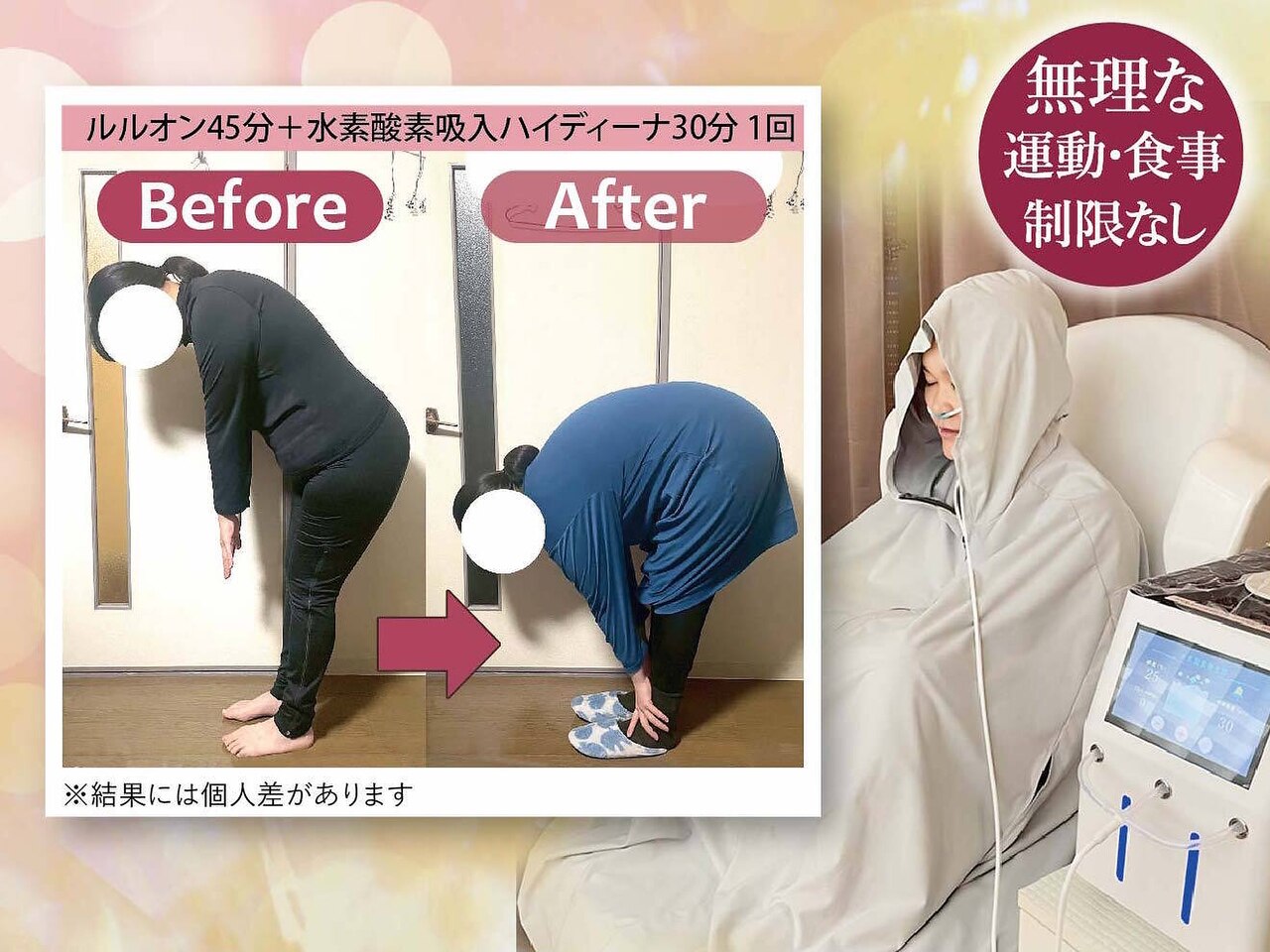 ヨサパーク ノア(YOSA PARK Noa)｜ホットペッパービューティー